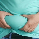 Obesitas Adalah