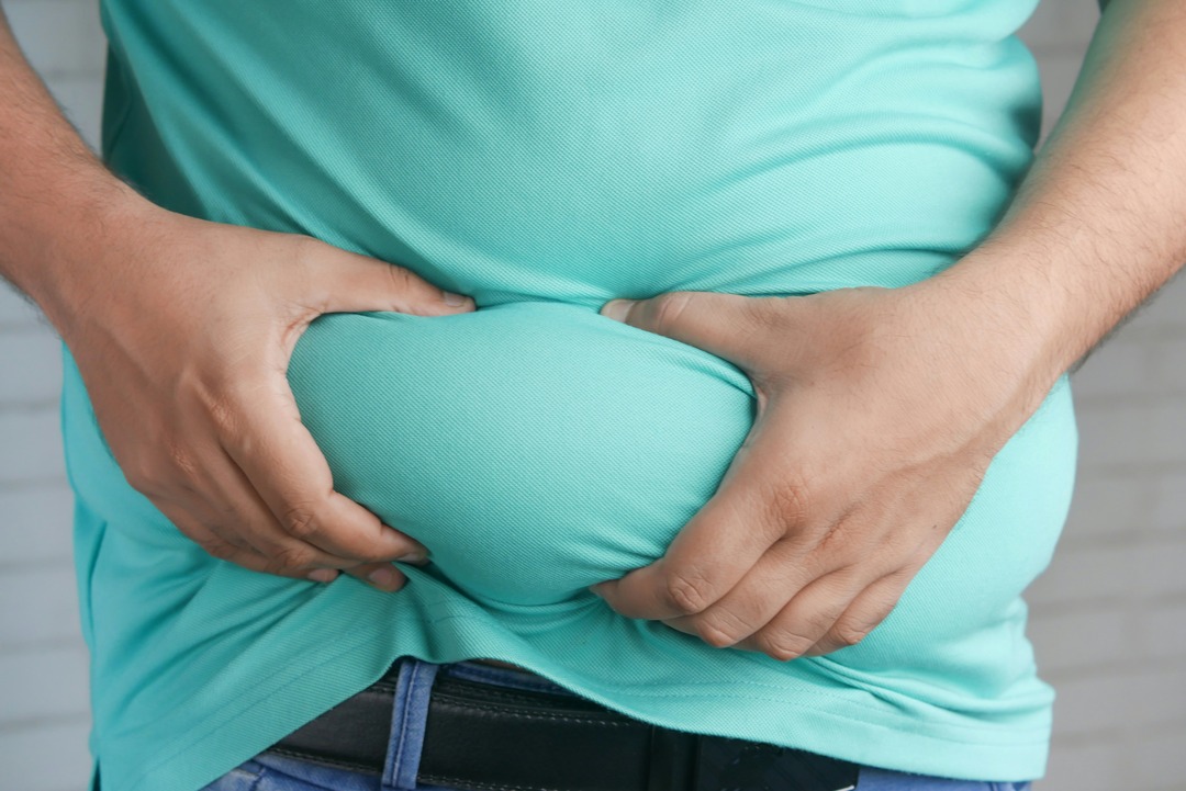 Obesitas Adalah Masalah Kesehatan, Bukan Sekadar Berat Badan