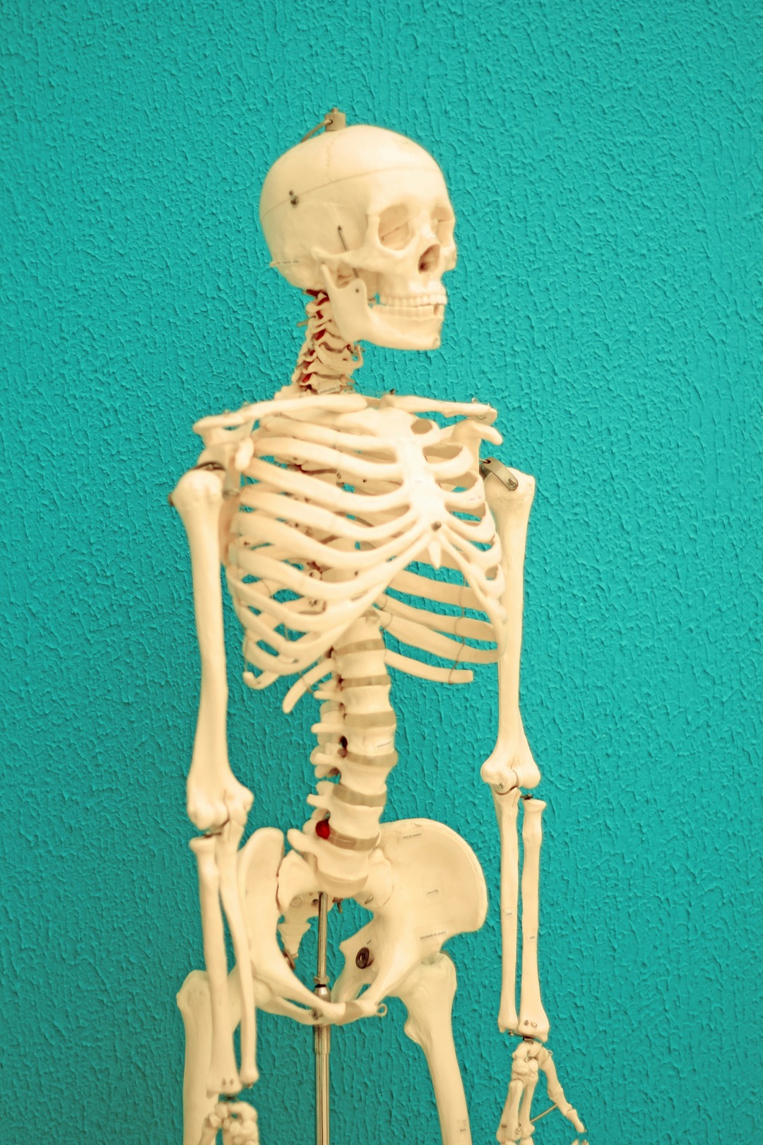 Waspada Tulang Keropos, Kenali Ciri-Ciri Osteoporosis Sejak Dini